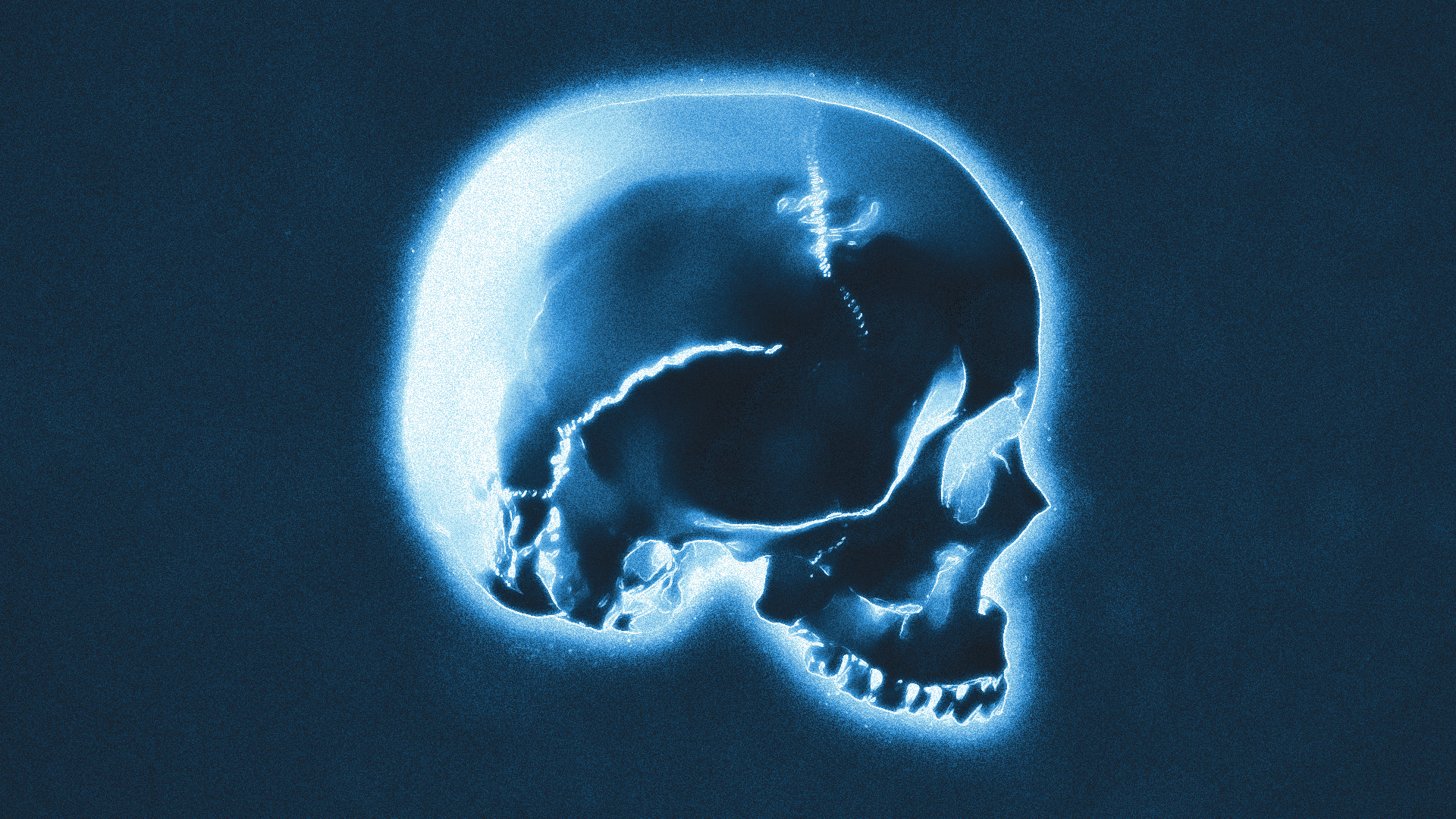How to make an X-Ray Effect in Adobe Photoshop